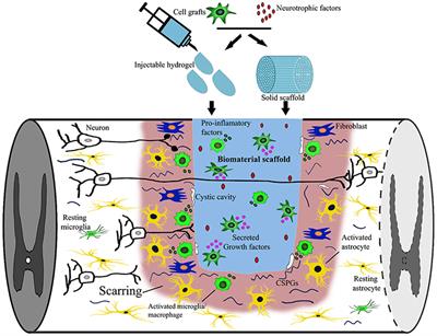 Biomaterial-Supported Cell Transplantation Treatments for Spinal Cord Injury: Challenges and Perspectives